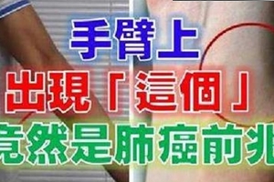 手臂上出現『這個』，竟然是肺癌前兆！特別是這種人，快檢查一下自己的手臂吧！不然就太晚了....... 