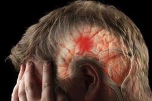 腦血栓發生前，一定會出現這６個徵兆！為了家人，看一眼！把握關鍵救命時刻...