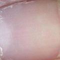 肝主筋」，指甲是「筋」的一種，因此毒素在肝髒蓄積時，指甲上有所明顯的信號