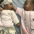 三胎媽媽生下三胞胎其中倆寶寶患先心病醫生巧手救命