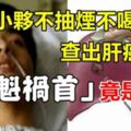 34歲小伙不抽煙不喝酒,被查出肝癌晚期,「罪魁禍首」都是因為妻子……