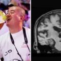 喝太多隨時變「金魚腦」　日本研究：愛喝酒的人大腦會加速萎縮20%