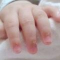 寶寶的指甲會「說話」，遇到這4種狀況不能忽視，寶媽來看看