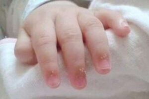寶寶的指甲會「說話」，遇到這4種狀況不能忽視，寶媽來看看
