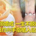 永恆婚戒一生不脫戒指紐約興手指植入鑽石