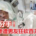 覺得男友不思上進想分手女慘遭狂砍百刀毀容命危