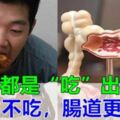 腸癌多是自己「吃」出來的，醫生告訴你：2吃3不吃，養成健康飲食習慣！