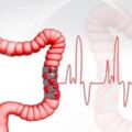 新竹醫師揭秘：不當的飲食習慣，罹患「大腸癌」的風險增大，防大腸癌上身，3類「地雷」食物少碰