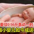 女嬰體重僅0.56斤轟動一時，被稱為世界上最小的嬰兒，她如今成這樣