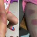 一國小老師體罰10歲女童，還叫4學生輪流毆打，如今僅被暫停教學工作