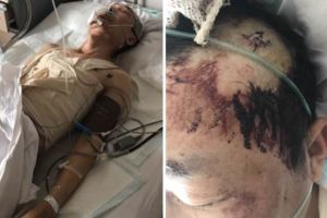 中國老人救2歲童卻被媽媽誤會是人口販子，完全不給他機會解釋直接打斷人家13根肋骨！