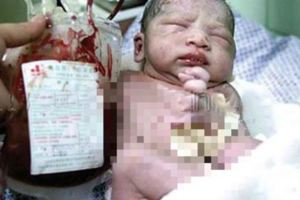 重病母親堅持不墮胎，胎兒竟然用「這種方式」救母報恩！祝福她！阿彌陀佛