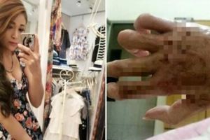 台灣美女在去年泰國「四面佛爆炸案」中重傷，如今出院竟然變這樣…好讓人心疼！