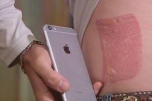 快檢查你的手機殼是不是「這款」，目前已經緊急回收27萬個防止再有人「燒傷毀容」！