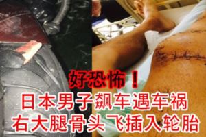 【好恐怖！】日本男子飆車遇車禍　右大腿骨頭飛[插·入]輪胎　