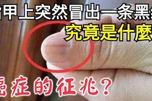 指甲上突然冒出一條黑線究竟是什麼？癌症的徵兆？