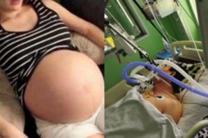 37歲產婦誕下龍鳳胎，丈夫狠心拔掉呼吸機，醫生卻為丈夫點讚！