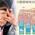 豬哥亮癌逝享壽70歲 大腸癌分期不可不慎！