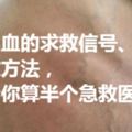 心梗、腦梗、腦出血的求救信號、急救方法，學會你算半個急救醫生