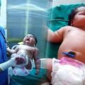 印度媽媽生下「全球史上最重女嬰」，她的誇張體重讓醫生驚呼：「簡直是生命的奇蹟」！