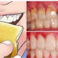 不用洗牙！六個方法就能去除牙菌斑！再也不怕洗牙痛痛了（圖示）