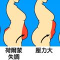 16種「不同體態隱藏著的健康狀況」　蘋果型身材內臟脂肪太多會有糖尿病