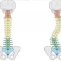 8個瑜伽拉伸體式，改善脊柱側彎