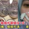 馬來女子戴隱形眼鏡僅1天，「眼睛刺痛、模糊不清」，差點失明！