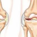 為什麼膝關節這麼容易疼痛？醫生終於說了大實話！以下6種因素會讓膝關節更「易痛」，看一看你中了幾點？