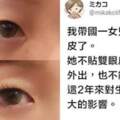 媽帶「國一女兒去整形」被罵爆！　她透露「已痛恨至快精神病」網看完深思