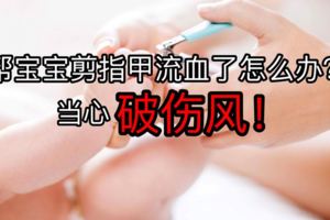 幫寶寶剪指甲流血了怎麼辦？當心破傷風！