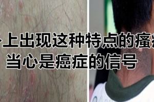身上出現這種特點的瘙癢當心是癌症的信號
