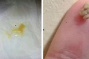 咳嗽有黃痰、時不時咳出白色顆粒，用它泡水喝7天能改善