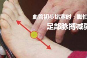 血管裡有沒有垃圾看這裡就知道，每個人都可以自測