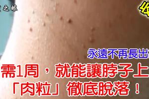 只需1周，就能讓脖子上的「肉粒」徹底脫落！永遠不再長出來！