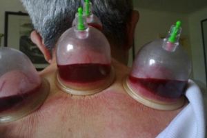 8年頸椎病，肩膀好僵硬，去廚房拿一食材，用用就好，為家人存