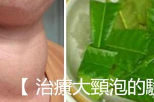 【治療大頸泡的驗方】什麼樣的人容易得甲狀腺結節？轉發功德無量~