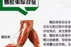 這5種病是「跑」出來的！愛跑步的人記得互相提醒