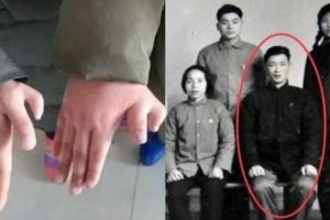 妻子連生3胎都是畸形，丈夫看到去世父親的照片，終於發現原因！