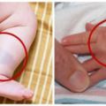 亞洲寶寶身上常出現的「瘀青胎記」，不只是「床母」做的記號，居然跟這個「偉大人物」有關！