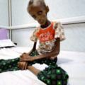 遭沙國全面封鎖葉門每天130孩童死亡