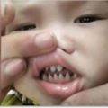 寶寶天生長一副鯊魚牙齒，親友笑：你兒子有貴族血統！沒想到網友卻說：這父母太缺德！