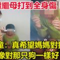 9歲童遭繼母打到全身傷！男童：真希望媽媽對我，能像對那隻狗一樣好！