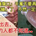 「這種傷口」千萬不要再不用「OK繃」了，不然一定爛掉！快分享出去，90%的人都不知道.