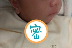 4個月大寶寶鼻塞聲太大，醫生挖出驚人「2公分鼻屎柱」，媽媽在旁看傻眼，笑呼「鼻屎怪」！