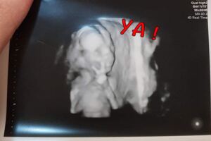 照超音波發現新生嬰「居然在自拍」　活潑比YA招呼：爸媽泥們好～