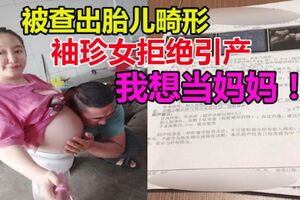 袖珍女懷孕後被查出胎兒畸形，拒絕醫生為她引產：我想當媽媽