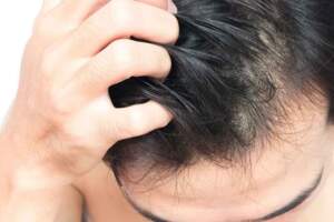 頭髮一掉一大把，怎麼做才能挽救脫髮？提醒：這5件事要做到位