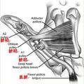 病「微」苦卻「重」的腱鞘炎：自測、護理與預防治療大全