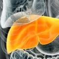 脂肪肝這種病到底有多嚴重？營養師告訴你答案，吃飯時注意三件事